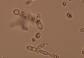 特許取得の天然酵母菌を使用した優光泉プレミアム